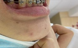 南山矫正牙齿哪家好？这几家医院靠谱吗？怎么选才合适？