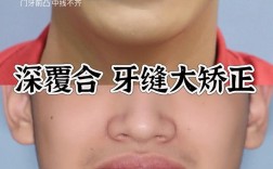 牙缝大修复该挂正畸科吗？