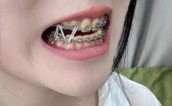 矫正牙齿后，反弹是否真的无法避免？