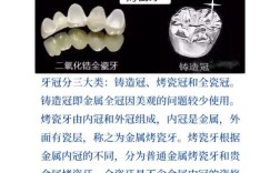 能种牙千万別烤瓷牙