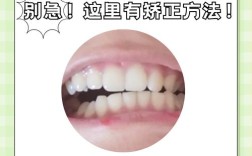 牙齿咬合不齐矫正