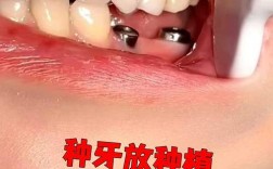 宜昌有植过牙的