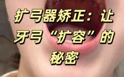 扩张牙的治疗方法哪种更安全有效？