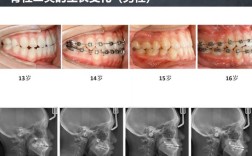 成人正畸患者比例有多少？增长趋势及原因何在？
