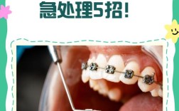 正畸钢丝顺序步骤图解具体如何操作？