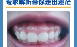 正畸时骨头也凸怎么办