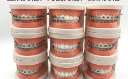 正畸弓丝没有入托槽