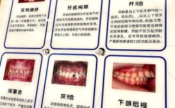 正畸中的平道有什么作用