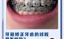 25岁能不能矫正牙齿