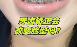 牙齿矫正会影响脸型吗？这些变化你知道吗？