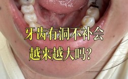 正畸过程中有蛀牙