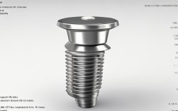 2025种植牙螺丝固位图解，现在固位方式更稳了吗？