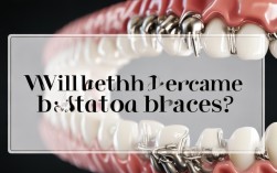 2025矫正牙齿，牙齿会变黑吗？