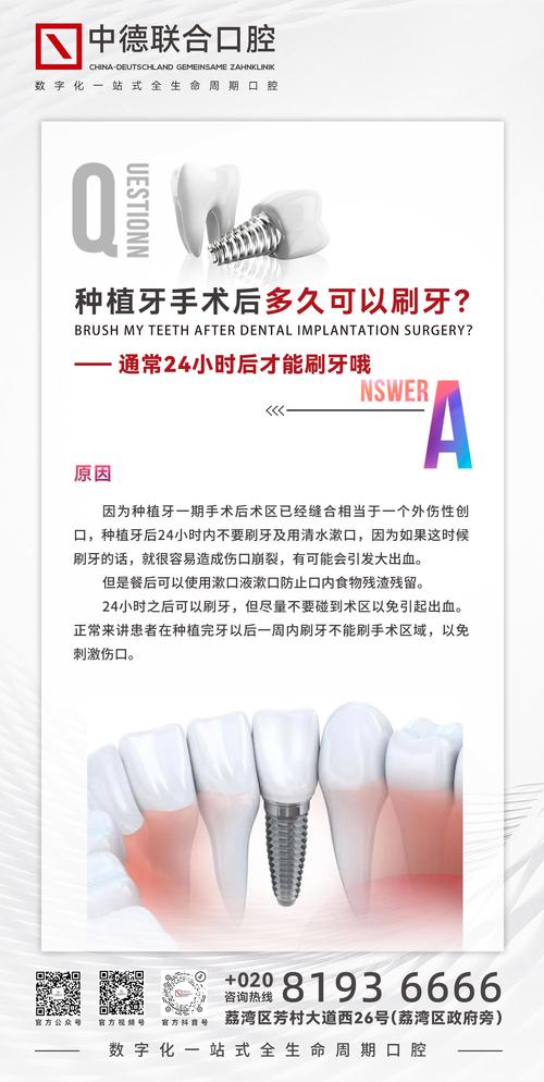 种植牙能用多久？这些因素影响寿命！-图2