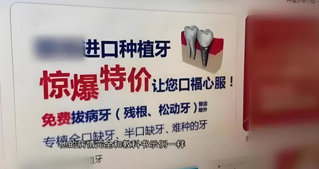 低价种植牙陷阱，究竟暗藏哪些风险？-图1