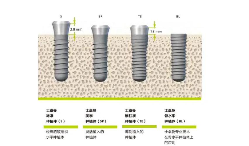 种植牙生物学宽度图片能直观展示什么关键信息？-图2