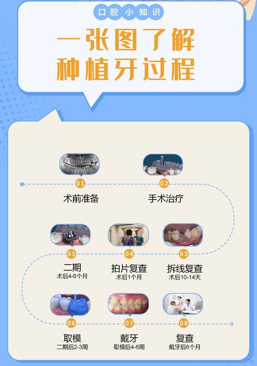 种植牙要排队吗?如何快速预约避免长时间等待?-图3 种植牙要排队吗?如何快速预约避免长时间等待?-图3