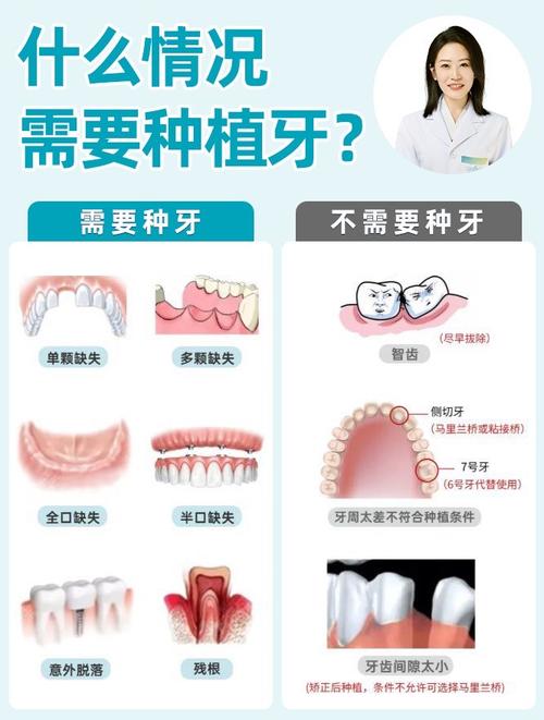 为什么要及时种植牙-图1 为什么要及时种植牙-图1