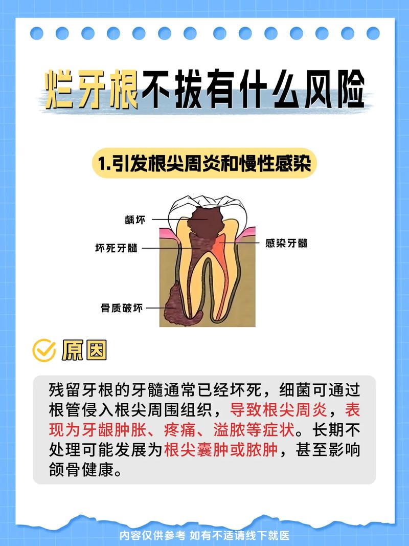 种植牙会有哪些风险?这些隐患如何规避?-图1 种植牙会有哪些风险?这些隐患如何规避?-图1