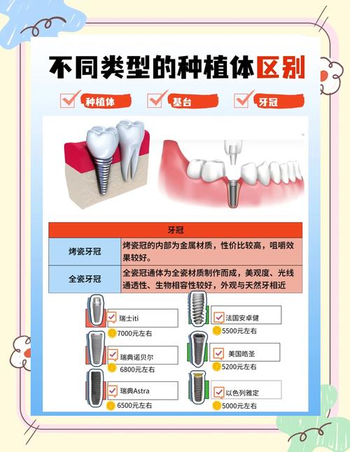 种植牙挑选该注意哪些关键因素？品牌、医生还是技术？-图3