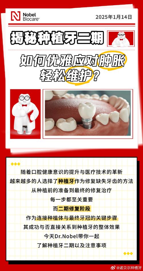 诺贝尔种植牙为何要一万？价格是否虚高？-图2