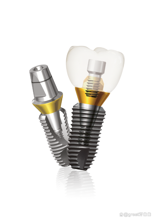 诺贝尔种植牙为何要一万？价格是否虚高？-图3