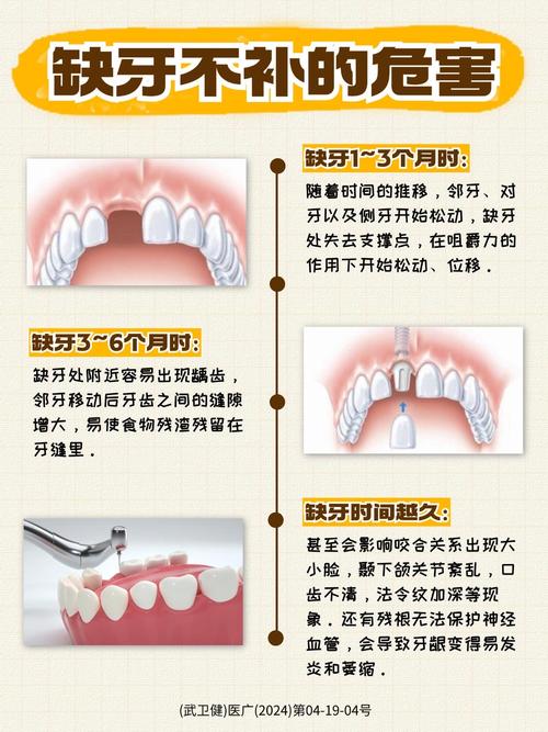 种植牙失败的影响-图3 种植牙失败的影响-图3