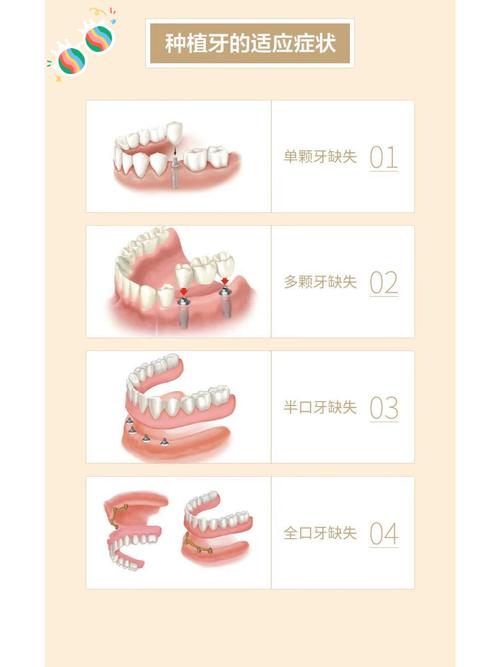 种植牙怎么接诊-图2
