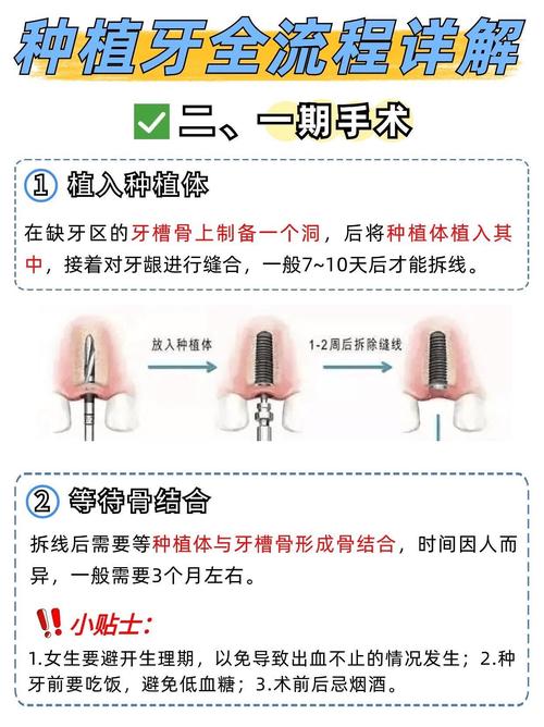 种植牙怎么接诊-图1