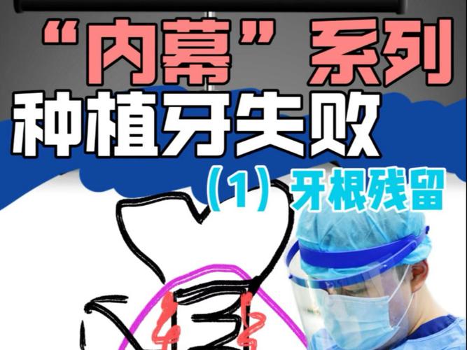 种植牙失败了如何处理?应对方法有哪些?-图3 种植牙失败了如何处理?应对方法有哪些?-图3