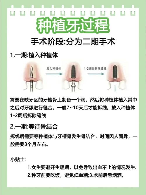 常州种植牙注意事项有哪些？这些关键点你必须知道吗？-图1