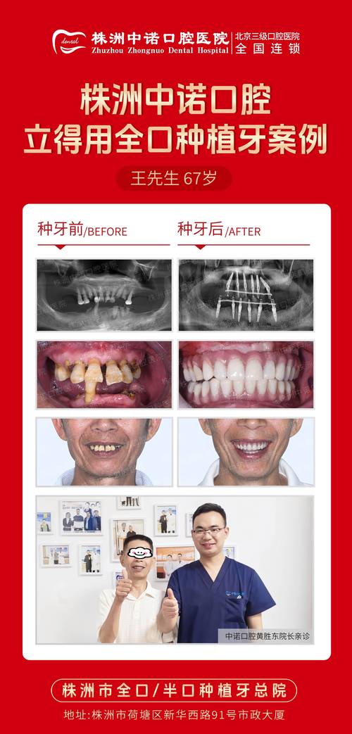 全国种植牙案例库，海量真实案例如何帮患者预见种植效果与风险？-图3