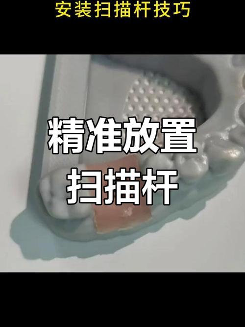 种植牙植入分析杆如何辅助精准种植?-图1 种植牙植入分析杆如何辅助精准种植?-图1