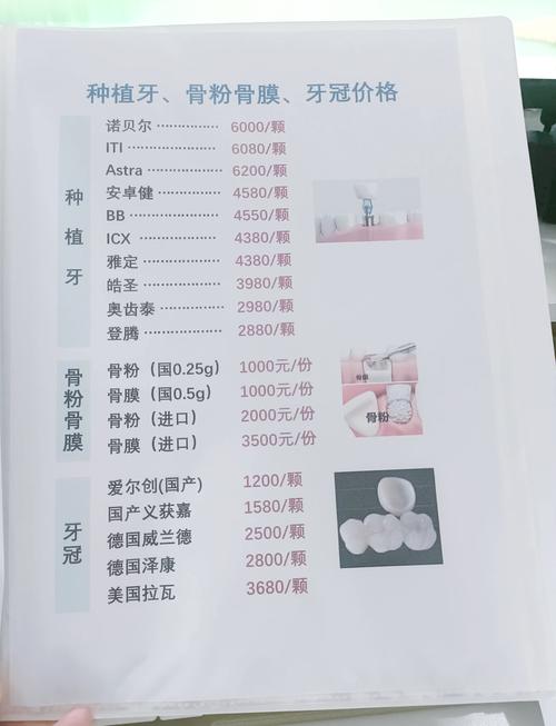 登腾种植牙价格多少？不同地区医院收费差多少？-图1