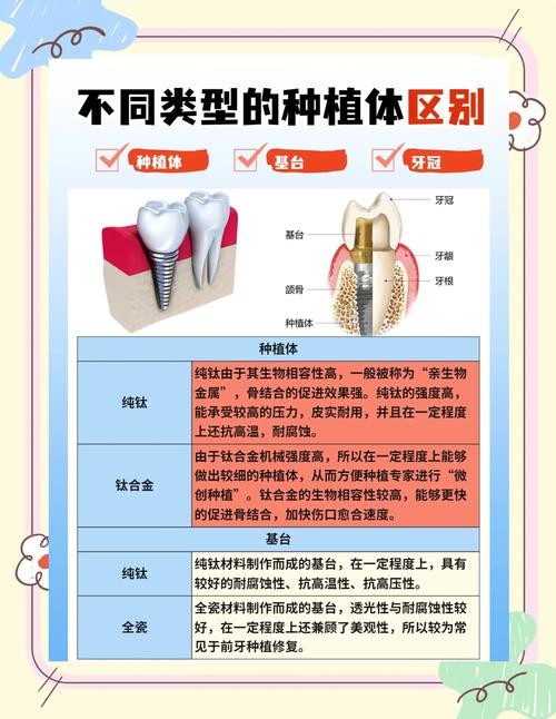 种植牙分解图片大全能清晰展示种植牙的哪些关键组成部分？-图3