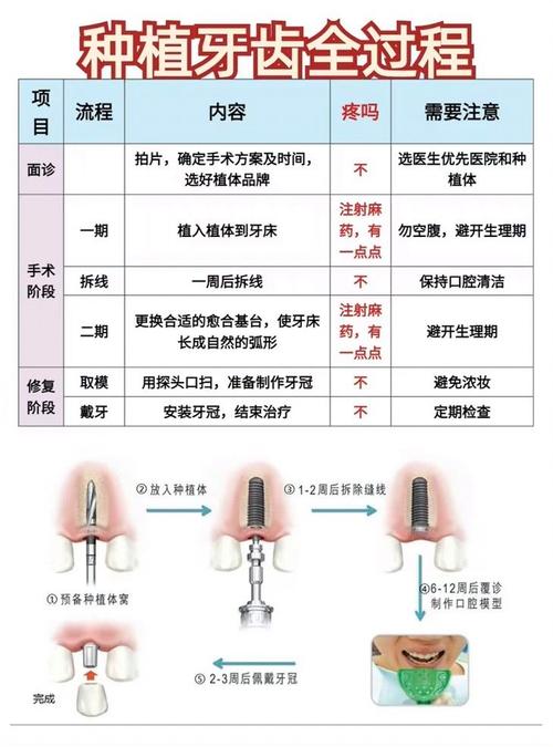 如何掌握种植牙接诊的核心技巧与沟通要点？-图2
