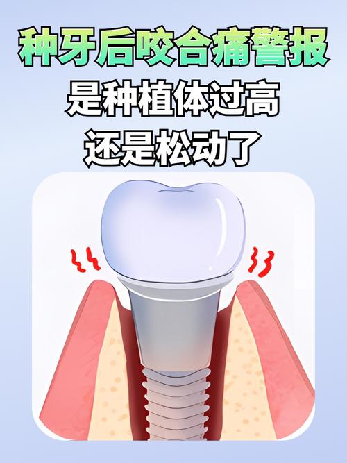 种植牙后疼痛怎么办?是正常现象吗?-图2 种植牙后疼痛怎么办?是正常现象吗?-图2