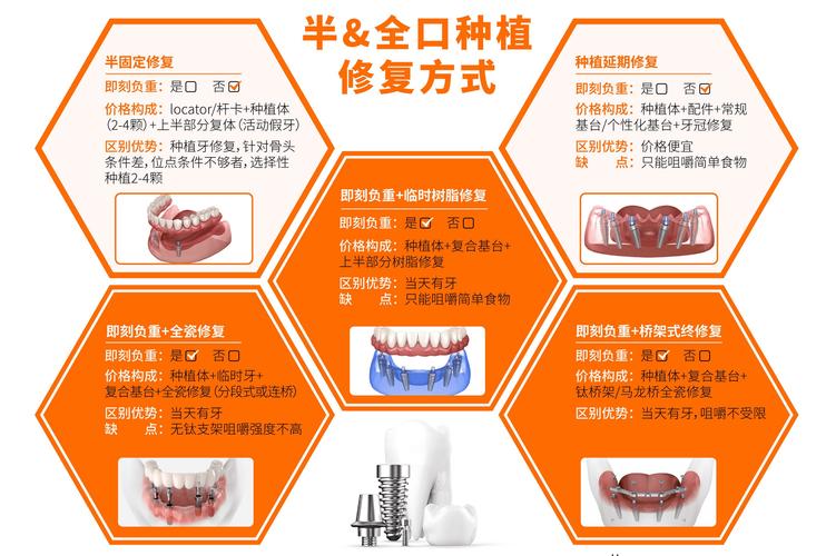 种植牙系统哪个好?品牌如何挑选适合自己的?-图1 种植牙系统哪个好?品牌如何挑选适合自己的?-图1