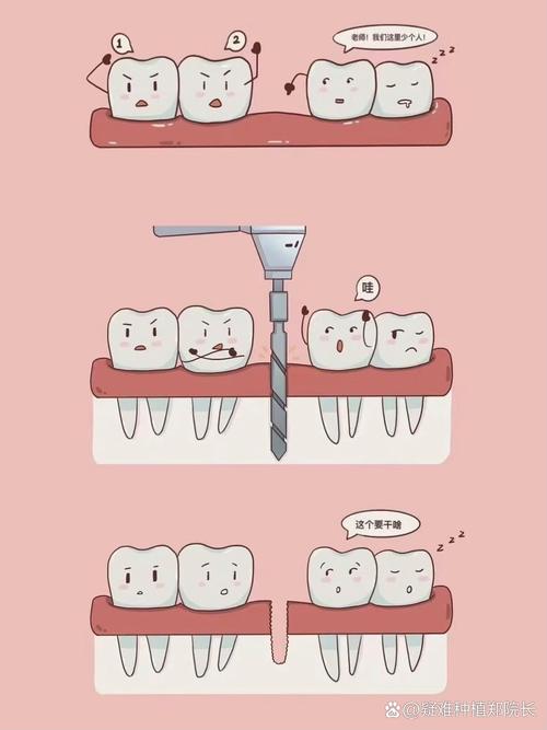 中秋种植牙靠谱吗？现在做来得及吗？-图3
