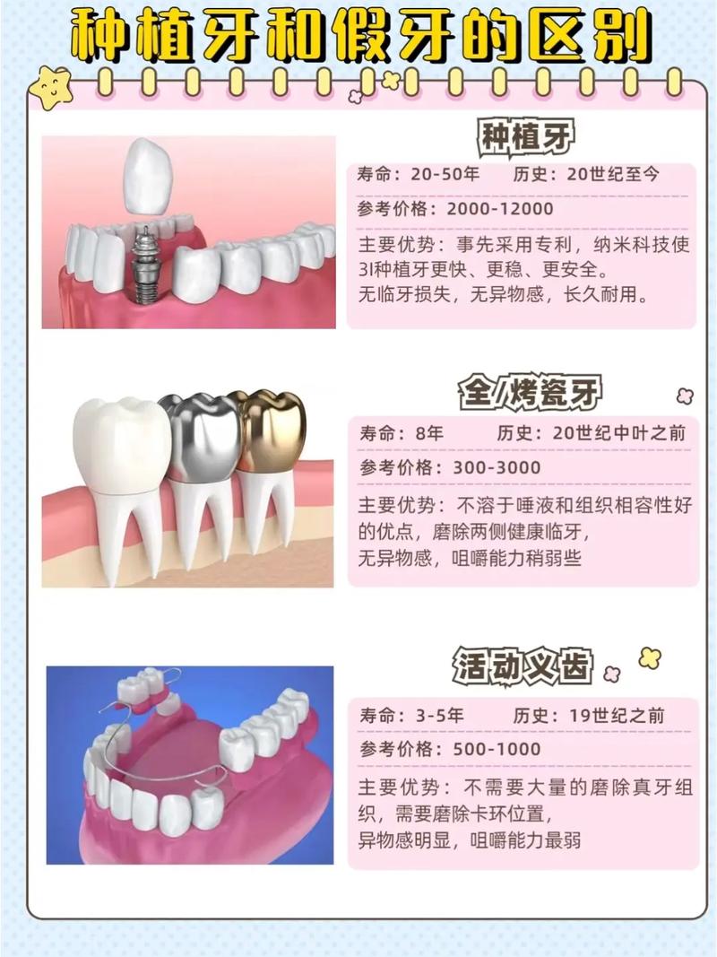 桩冠假牙和种牙有何不同？哪种更适合你？-图1