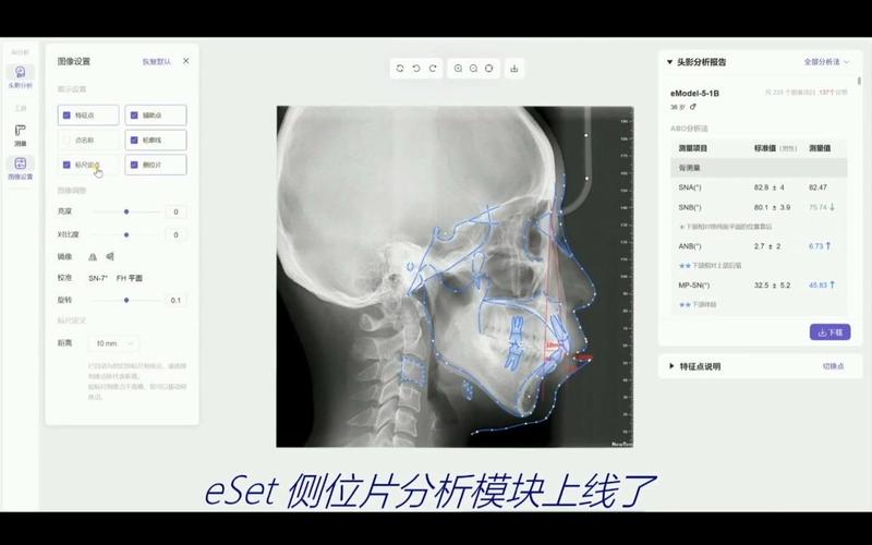 正畸头影测量McNamara-图2