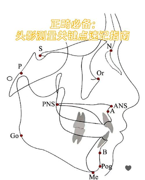 正畸头影测量McNamara-图1