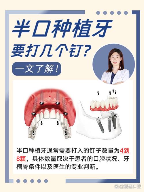 口腔颌面外科能否进行种植牙治疗?-图2 口腔颌面外科能否进行种植牙治疗?-图2