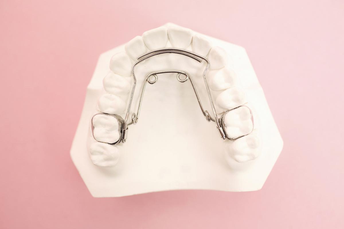 insignia精准正畸托槽如何实现牙齿精准矫正？-图2