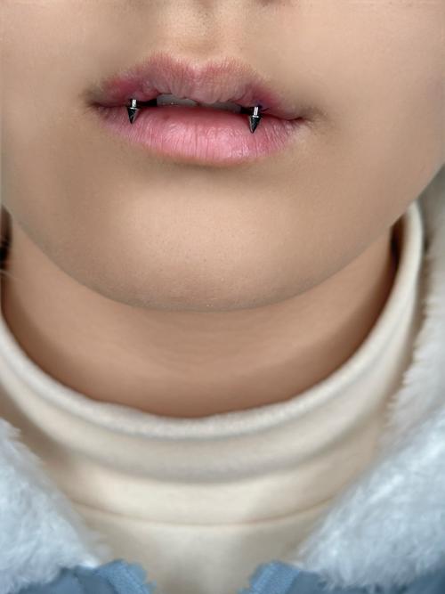 种在牙里面的钉子究竟有多长?-图1 种在牙里面的钉子究竟有多长?-图1