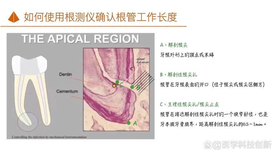 第六代vdw根测仪的详细使用方法与操作步骤是什么？-图1