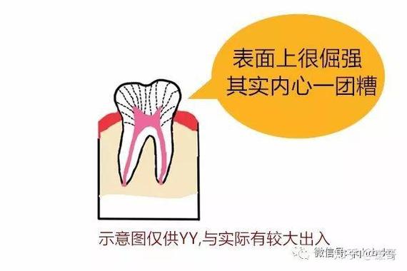 种完牙后多久能喝啤酒?-图3 种完牙后多久能喝啤酒?-图3