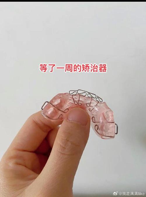 mrc地包天矫正器佩戴的正确方法具体步骤到底是怎样的?-图2 mrc地包天矫正器佩戴的正确方法具体步骤到底是怎样的?-图2