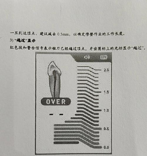 propex根测仪使用方法是什么？具体操作步骤有哪些？-图2