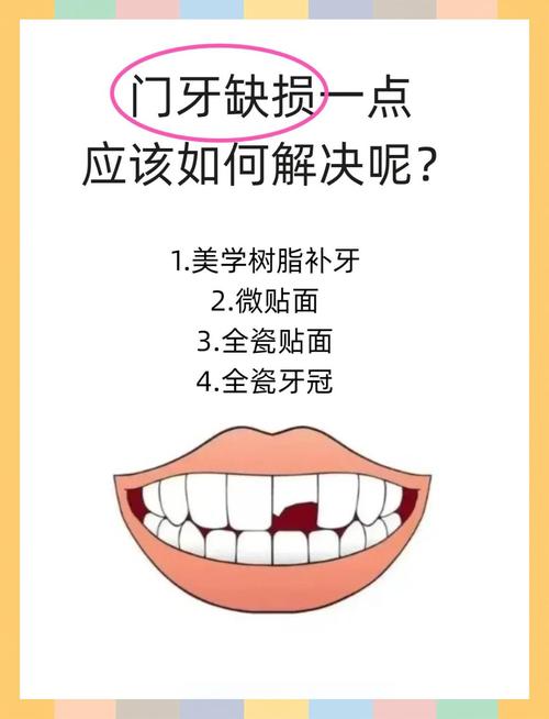 门牙缺了一半,哪种修复方法效果最好?-图1 门牙缺了一半,哪种修复方法效果最好?-图1